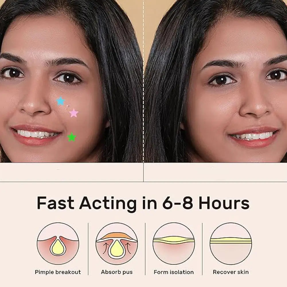 Étoile Colorée Bouton Patch Acné Coloré Invisible Acné Élimination Soins de la Peau Autocollants Correcteur Visage Spot Beauté Outils de Maquillage