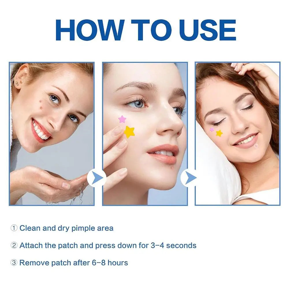 Étoile Colorée Bouton Patch Acné Coloré Invisible Acné Élimination Soins de la Peau Autocollants Correcteur Visage Spot Beauté Outils de Maquillage